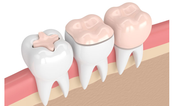 Initial Consultation